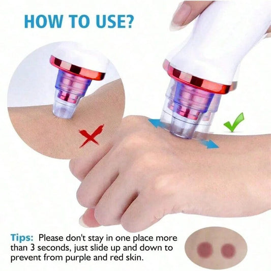 Facial Blackhead Remover
