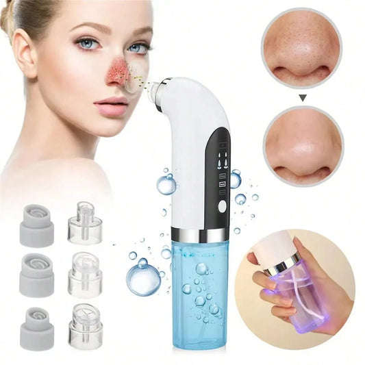 Facial Blackhead Remover