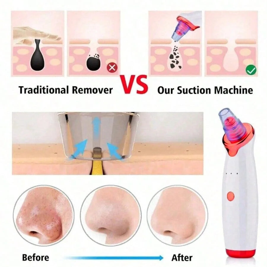 Facial Blackhead Remover